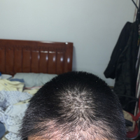 發(fā)際線用戶圖片