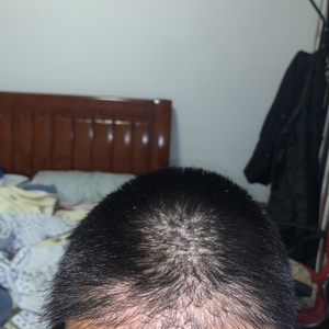 发际线分享社区