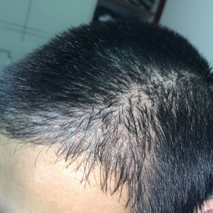 发际线分享社区