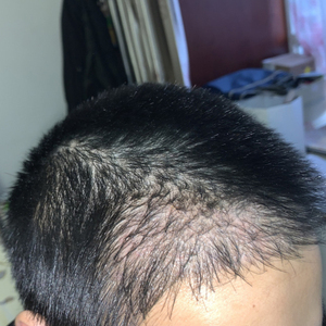 发际线分享社区