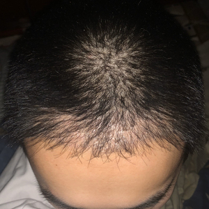 发际线分享社区