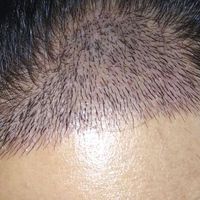 發(fā)際線用戶圖片
