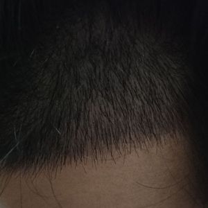 发际线分享社区