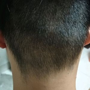 发际线分享社区