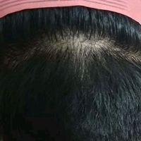 發(fā)際線用戶圖片