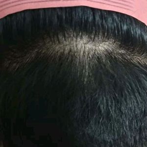 发际线分享社区