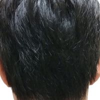 發(fā)際線用戶圖片
