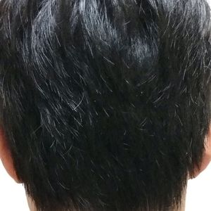 发际线分享社区