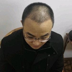 发际线分享社区