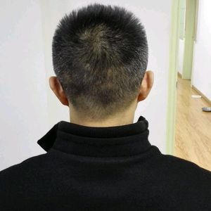 发际线分享社区