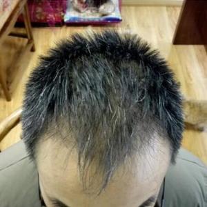 发际线分享社区