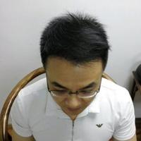 發(fā)際線用戶圖片