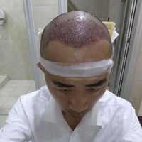 發(fā)際線用戶圖片