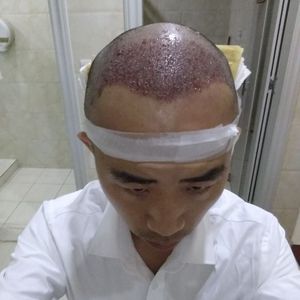 发际线分享社区
