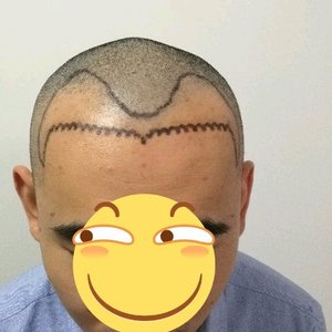 发际线分享社区