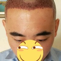 發(fā)際線用戶圖片