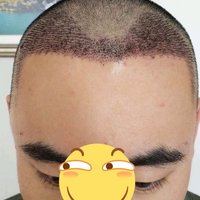發(fā)際線用戶圖片
