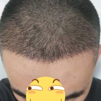 發(fā)際線用戶圖片