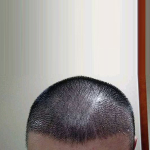 发际线分享社区