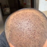 發(fā)際線用戶圖片