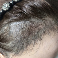 發(fā)際線用戶圖片
