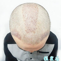 發(fā)際線用戶圖片