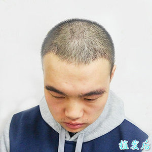 发际线分享社区