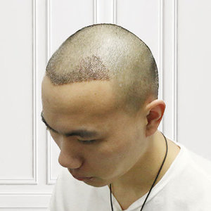 发际线分享社区