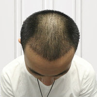 發(fā)際線用戶圖片