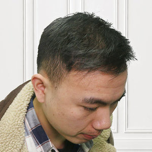 发际线分享社区