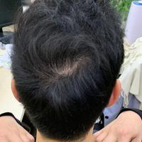 發(fā)際線用戶圖片