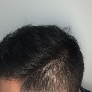 发际线分享社区