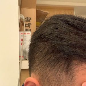 发际线分享社区
