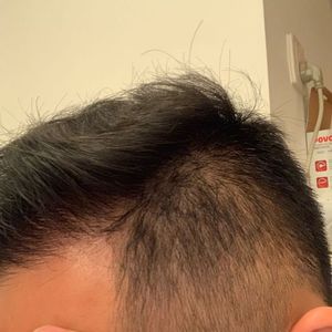 发际线分享社区