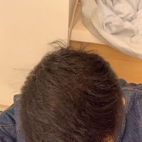 發(fā)際線用戶圖片