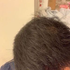 发际线分享社区