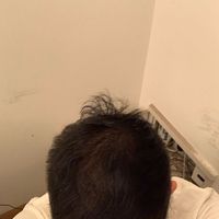 發(fā)際線用戶圖片