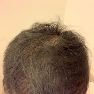 发际线分享社区