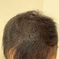 發(fā)際線用戶圖片