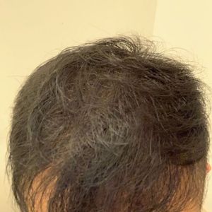 发际线分享社区