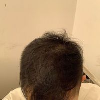 發(fā)際線用戶圖片