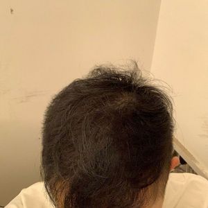 发际线分享社区