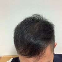 發(fā)際線用戶圖片