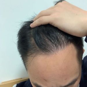 发际线分享社区