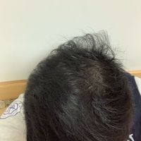 發(fā)際線用戶圖片