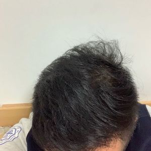 发际线分享社区