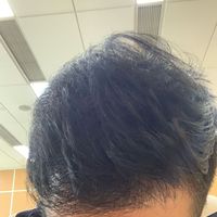 發(fā)際線用戶圖片