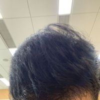 發(fā)際線用戶圖片