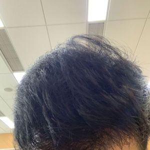 发际线分享社区