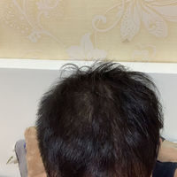 發(fā)際線用戶圖片